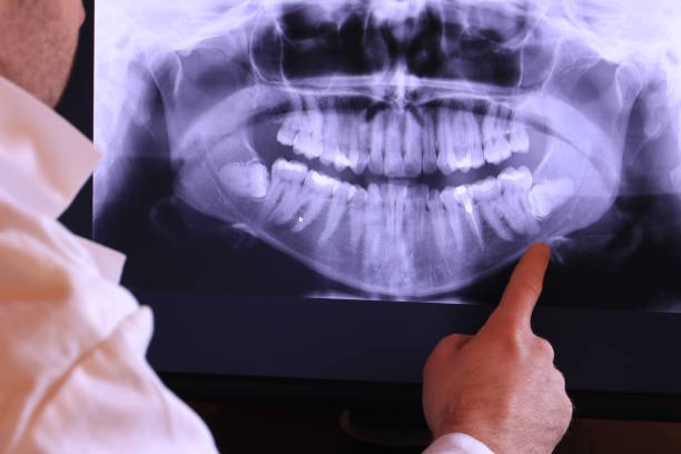 Best Broken or Chipped Tooth Repair in Winfield, MO